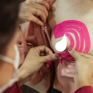 Bandagem + Laserterapia Aplicada à Amamentação e ao Pós-parto